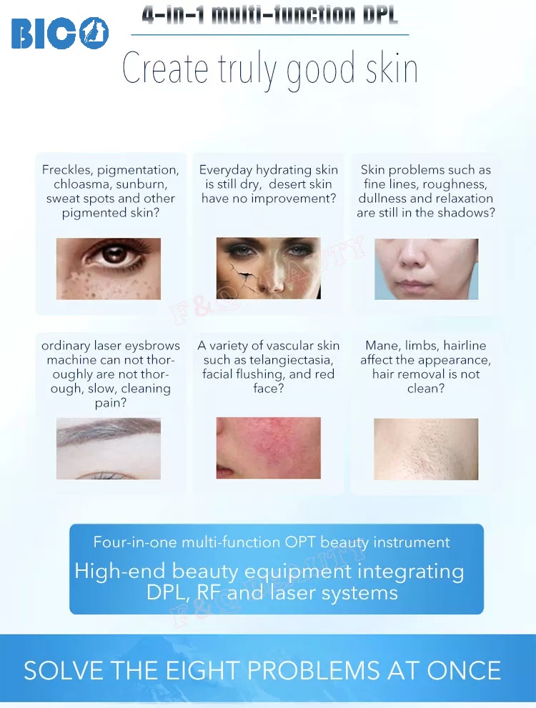 Hình ảnh&nbsp;Máy triệt lông 4in1 FQ Beauty IPL